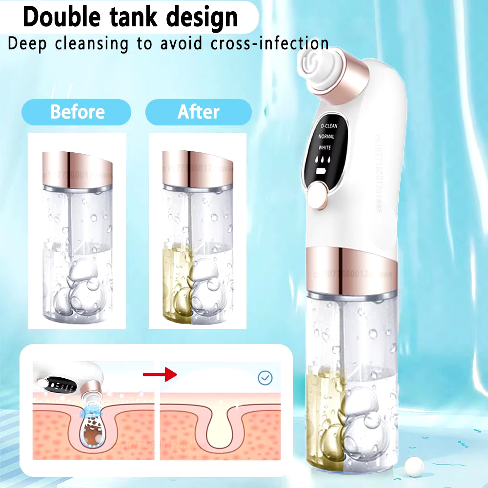 Professional Water-Cycle Blackhead Remover & Pore Vacuum – USB Rechargeable Deep-Cleansing Acne Treatment Device