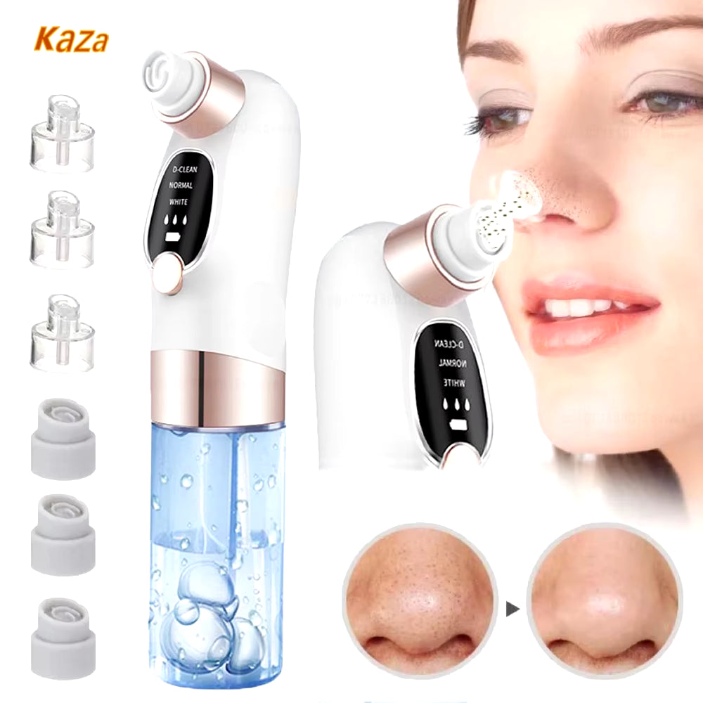 Professional Water-Cycle Blackhead Remover & Pore Vacuum – USB Rechargeable Deep-Cleansing Acne Treatment Device