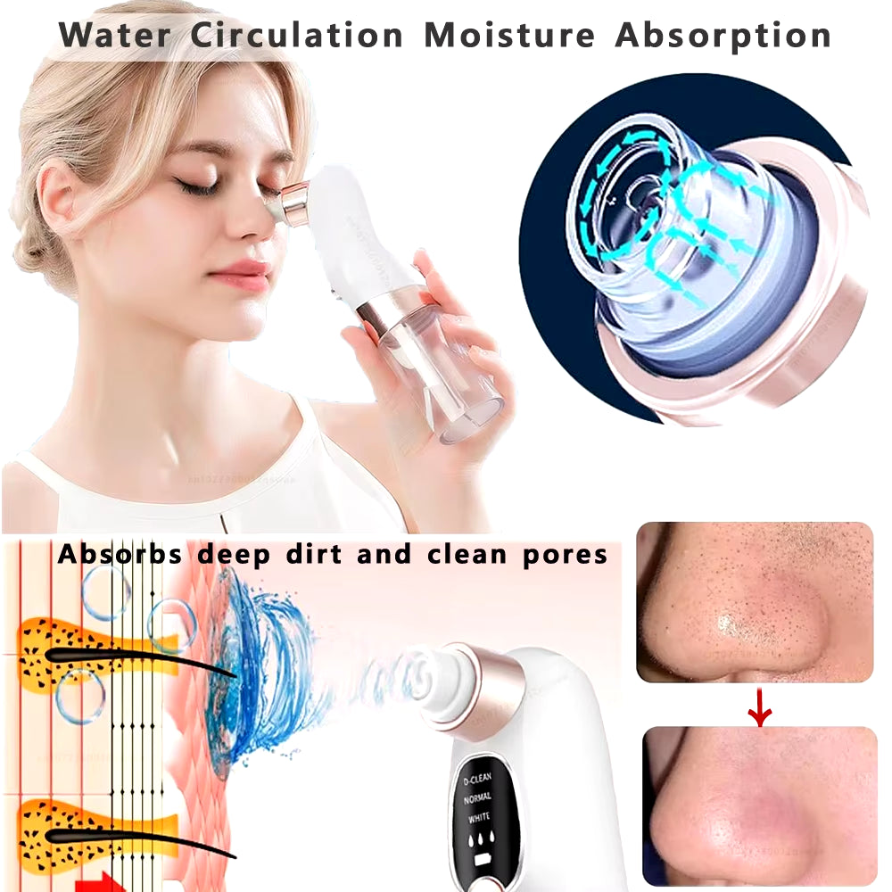 Professional Water-Cycle Blackhead Remover & Pore Vacuum – USB Rechargeable Deep-Cleansing Acne Treatment Device